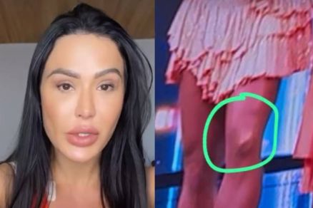 Gracyanne Barbosa chora em seu perfil no Instagram ao falar de cirurgia