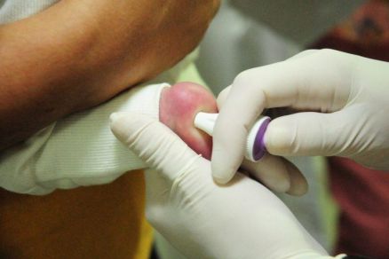 O Teste do Pezinho ou Triagem Neonatal  a forma mais efetiva e precoce de detectar a anemia falciforme