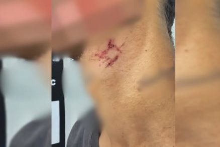 Escravo sexual  resgatado aps passar mais de um ano em crcere