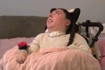 Jovem que nasceu sem crebro desafia a medicina e completa 20 