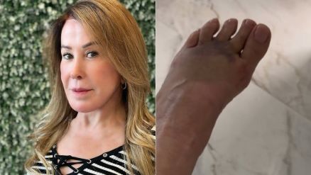 Zilu Camargo fraturou o p� ap�s cair da escada 