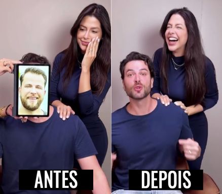 Gustavo Marsengo mostrou transforma��o ap�s procedimentos est�ticos