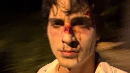 Fiuk postou foto com o rosto ensanguentado