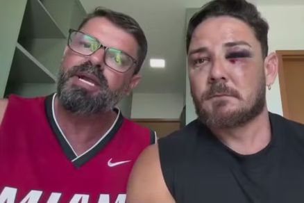 Cleiton Zabatta e Jhonny Andrade detalharam agress�o em praia