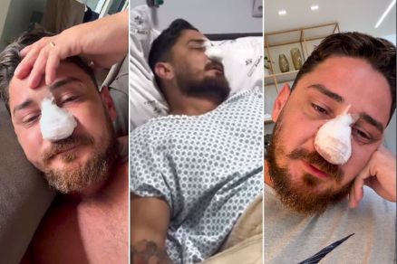 O empres�rio de Tangar� da Serra Jhonny Andrade, que foi agredido por ambulantes em Porto de Galinhas (PE).