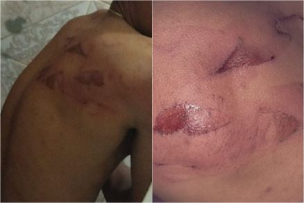 Trabalhadores foram agredidos e amea�ados de morte pelos patr�es em MT 