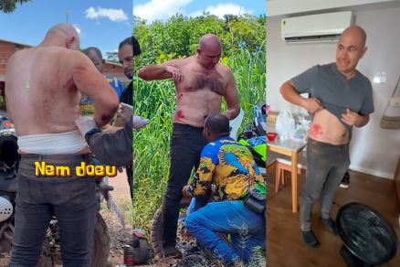 O prefeito Abilio, que caiu de moto e teve ferimentos leves