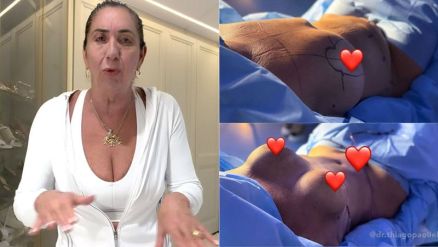 Margareth Serr�o falou sobre combo de cirurgias pl�sticas