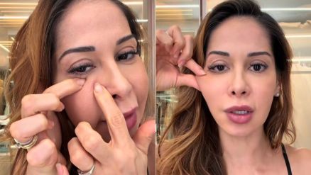 Ma�ra Cardi contou que far� cirurgia para retirar PMMA do rosto 