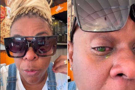 Cacau Prot�sio tem perda de vis�o ap�s usar pomada