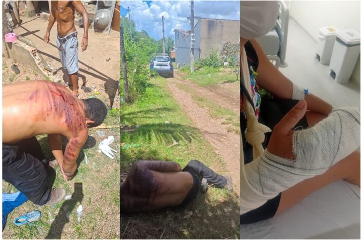 Homem decepa dedo de ex, leva salve de fac��o e � preso por PM