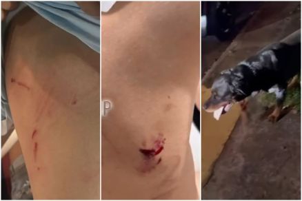 Crian�a apresentou diversos ferimentos ap�s ser atacada por cachorro rottweiler 