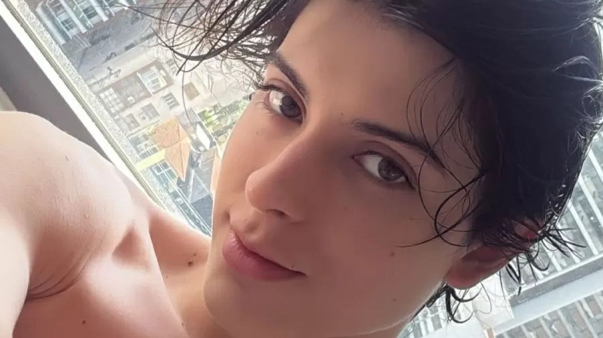 Zé Longuinho exibe resultado de feminização facial - MidiaNews