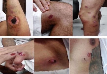 Pres&iacute;dio Ferrugem - Sinop